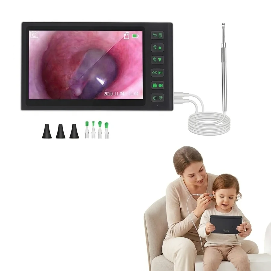 7" Screen Smart Visual Ear Cleaner